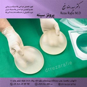 پروتز سینه در تهران - دکتررفیع