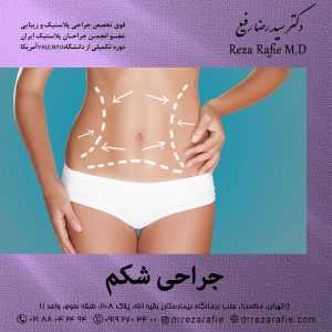 جراحی شکم - دکتر رفیع