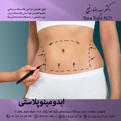 ابدومینوپلاستیابدویمنوپلاستی در تهران - دکتر رفیع