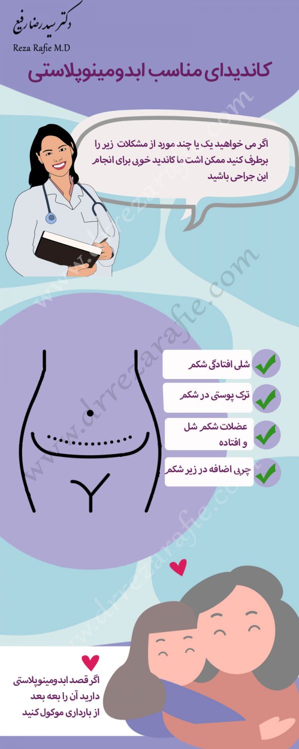 ابدویمنوپلاستی در تهران - دکتر رفیع