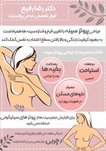 پروتز سینه در تهران - دکتر رضا رفیع