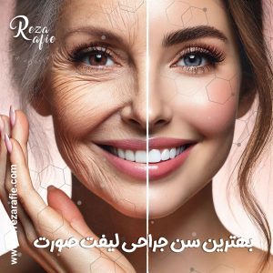بهترین سن جراحی لیفت صورت + دکتر رضا رفیع