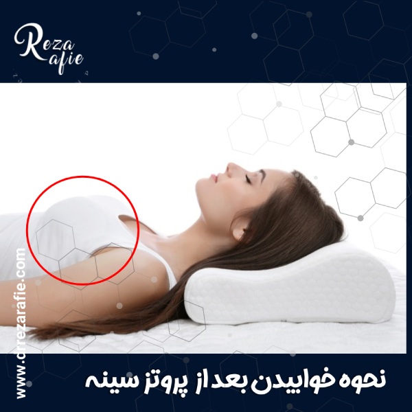 نحوه خوابيدن بعد از عمل پروتز سينه