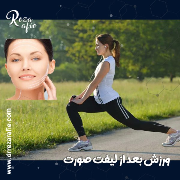 ورزش بعد از لیفت صورت